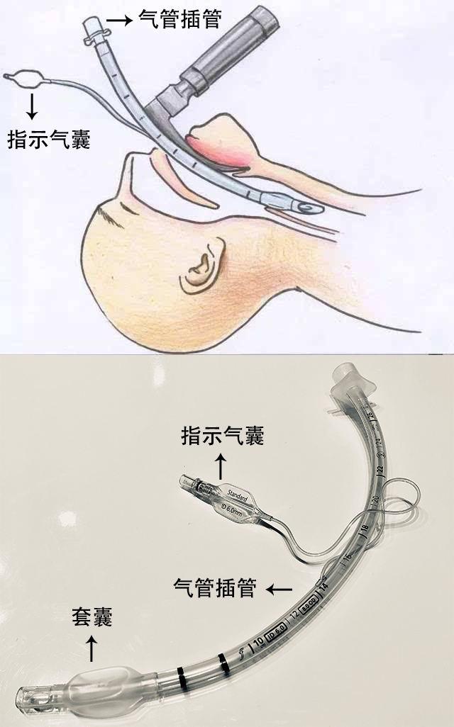 贊?。?！250萬指示氣囊，客戶100%滿意！